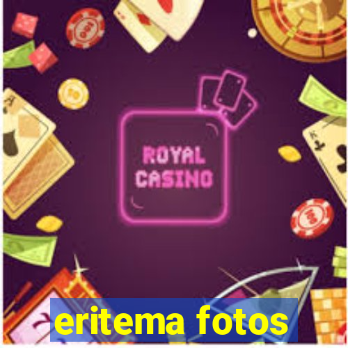 eritema fotos